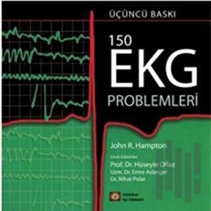 150 EKG Problemleri