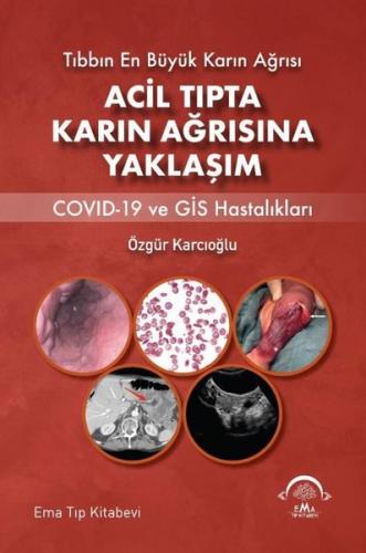 Acil Tıpta Karın Ağrısına Yaklaşım - Covid-19 ve GİS Hastalıkları