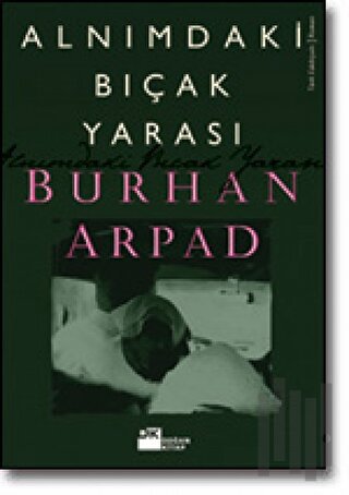 Alnımdaki Bıçak Yarası