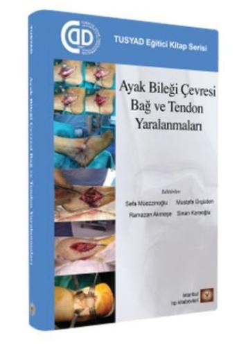 Ayak Bileği Çevresi Bağ ve Tendon Yaralanmaları