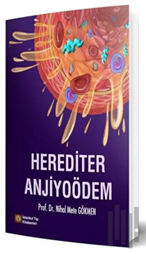 Herediter Anjiyoödem