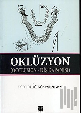 Oklüzyon