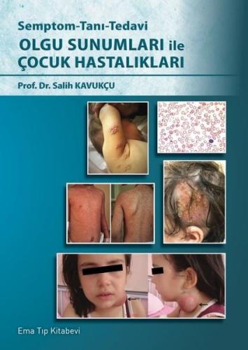 Olgu Sunumları ile Çocuk Hastalıkları - Semptom - Tanı - Tedavi (Ciltli)
